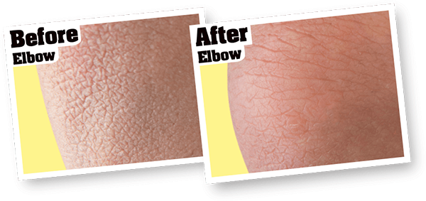 Skin Repair Cream Results
